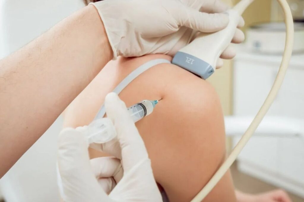 tendinite-calcaria-tratamento-dr-eric-curi-ortopedista-ombro-cotovelo-são-paulo