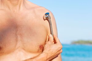 Artroplastia do ombro: saiba mais sobre a cirurgia