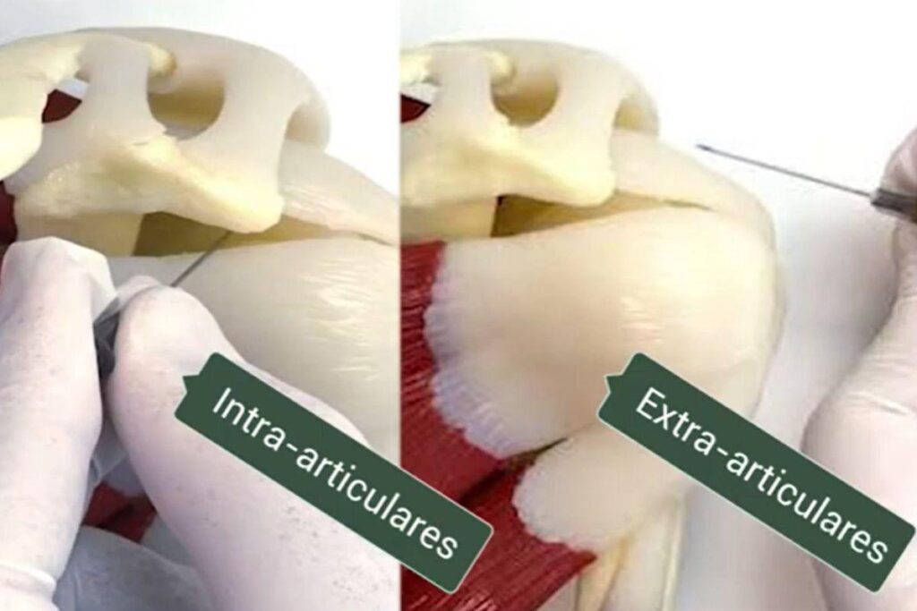 tratamento-ombro-dr-eric-curi-ortopedista-ombro-cotovelo-sao-paulo.
