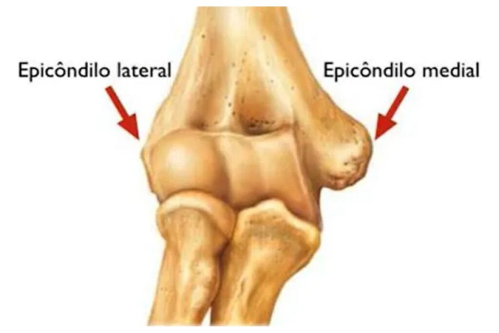 tendinite-no-cotovelo-sintomas-dr-eric-curi-ortopedista-ombro-cotovelo-são-paulo