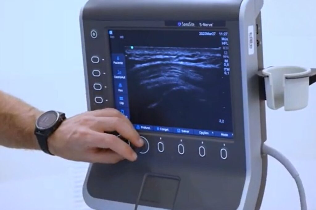 viscossuplementacao-cotovelo-dr-eric-curi-ortopedista-ombro-cotovelo-são-paulo