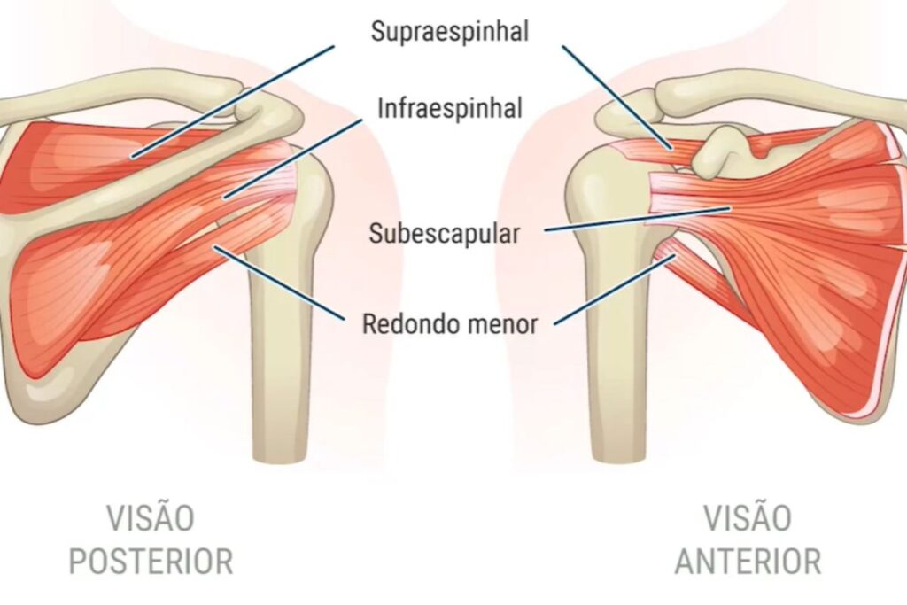 lesao-parcial-manguito-rotador-o-que-e-dr-eric-curi-ortopedista-ombro-cotovelo-sao-paulo